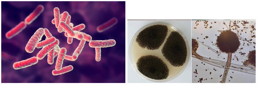 Bactérias e fungos são os agentes que levam à otite externa.