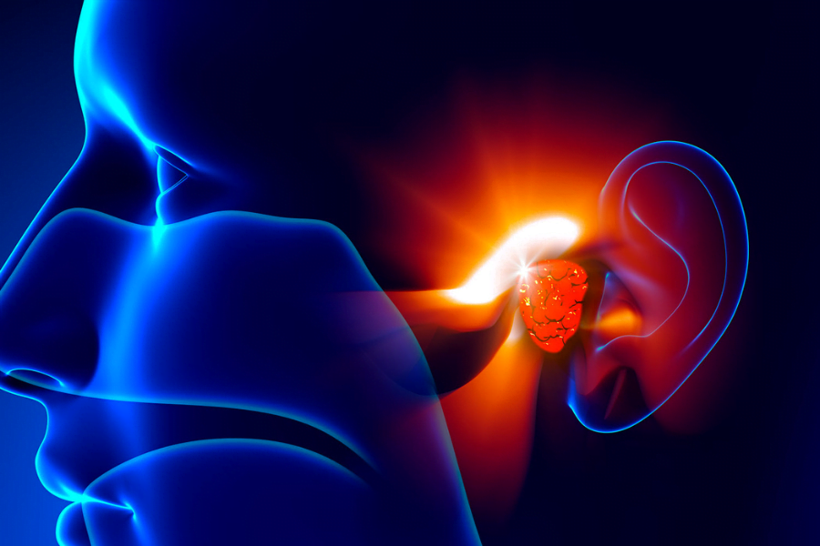 Adenoide, popularmente chamada de adenoide