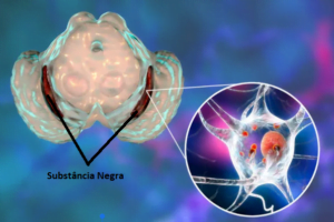Subtancia Nigra,