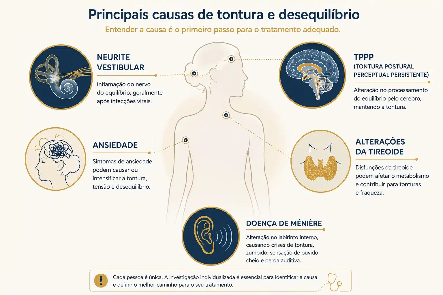 Ilustração das causas mais frequentes de tontura constante: neurite vestibular, PPPD, ansiedade, causas metabólicas e doença de Ménière