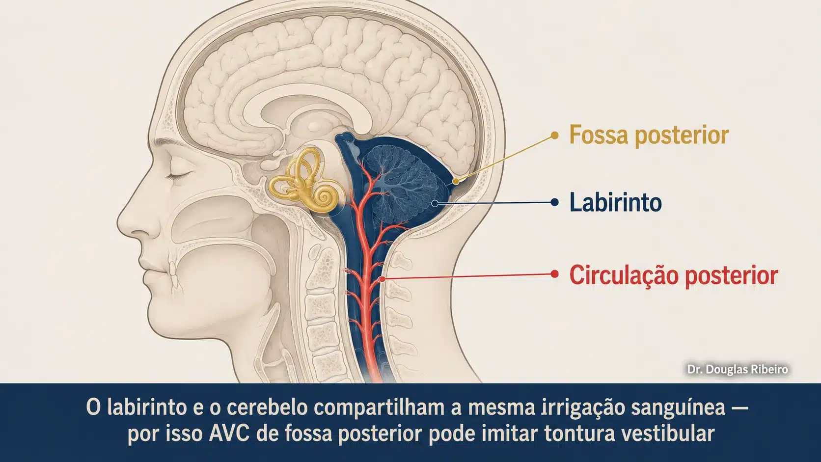 Diagrama do perfil da cabeça destacando a fossa posterior, o labirinto e a circulação vertebrobasilar, explicando por que AVC nessa região pode causar tontura