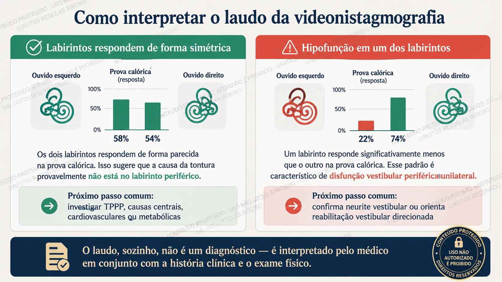 Diagrama explicando os dois principais padrões de resultado da videonistagmografia: resposta simétrica entre os labirintos e resposta assimétrica indicando hipofunção unilateral