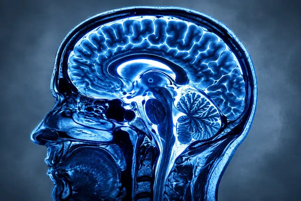 Imagem artística de ressonância magnética cerebral em tons de azul, representando a investigação neurológica da tontura