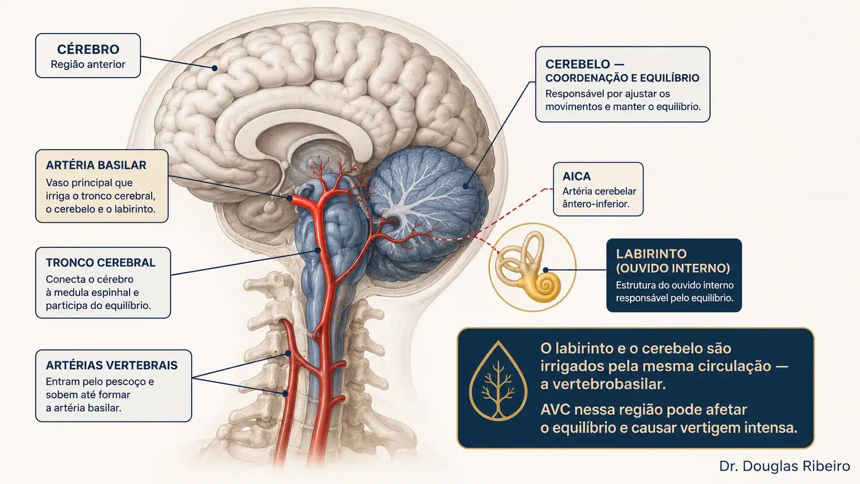 Diagrama anatômico mostrando a circulação vertebrobasilar, o cerebelo, o tronco cerebral e o labirinto, explicando por que AVC nessa região causa tontura