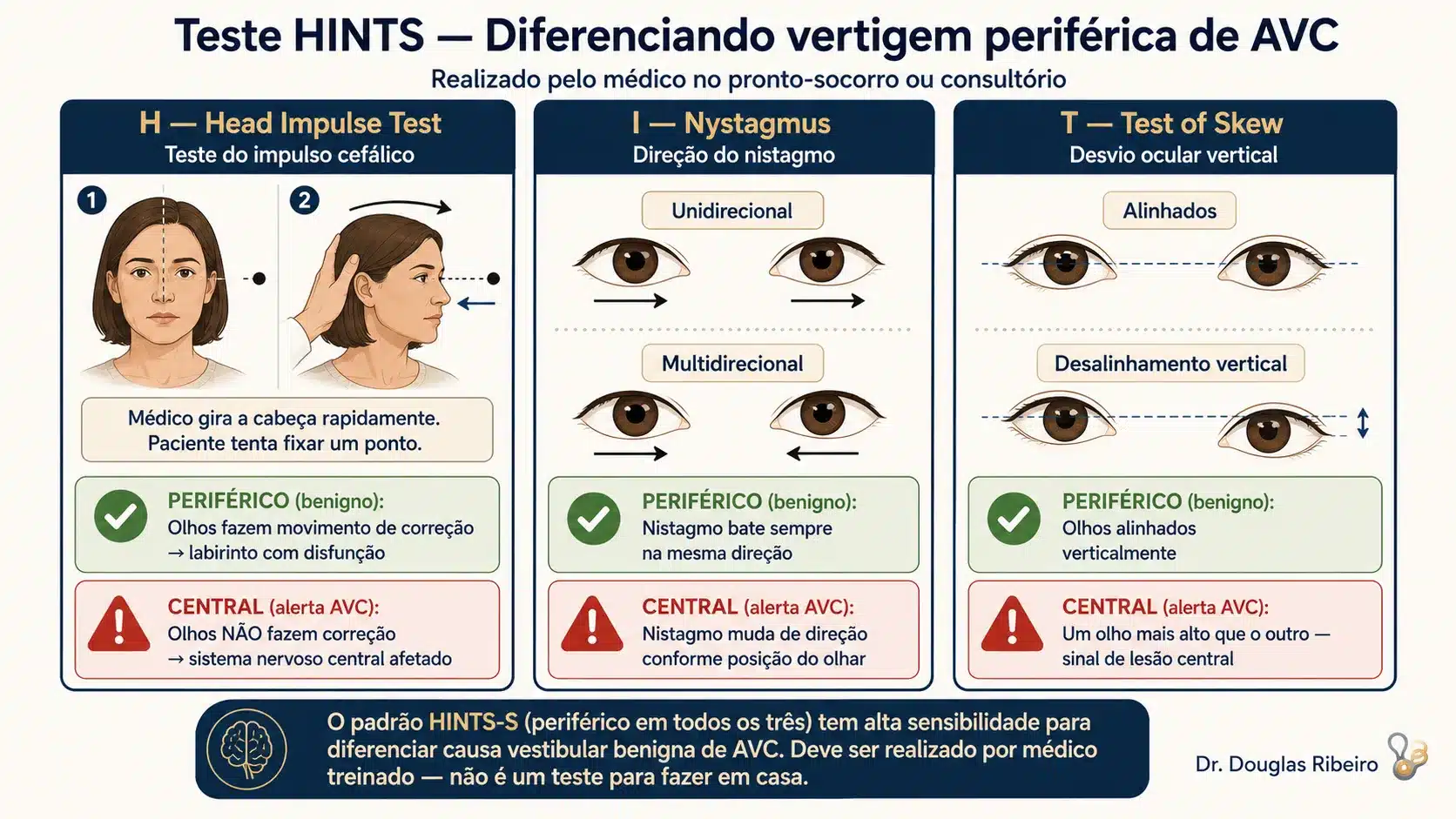 "Diagrama explicando o teste HINTS em três colunas: Head Impulse Test, direção do nistagmo e Test of Skew, com resultados que apontam para causa periférica ou central
