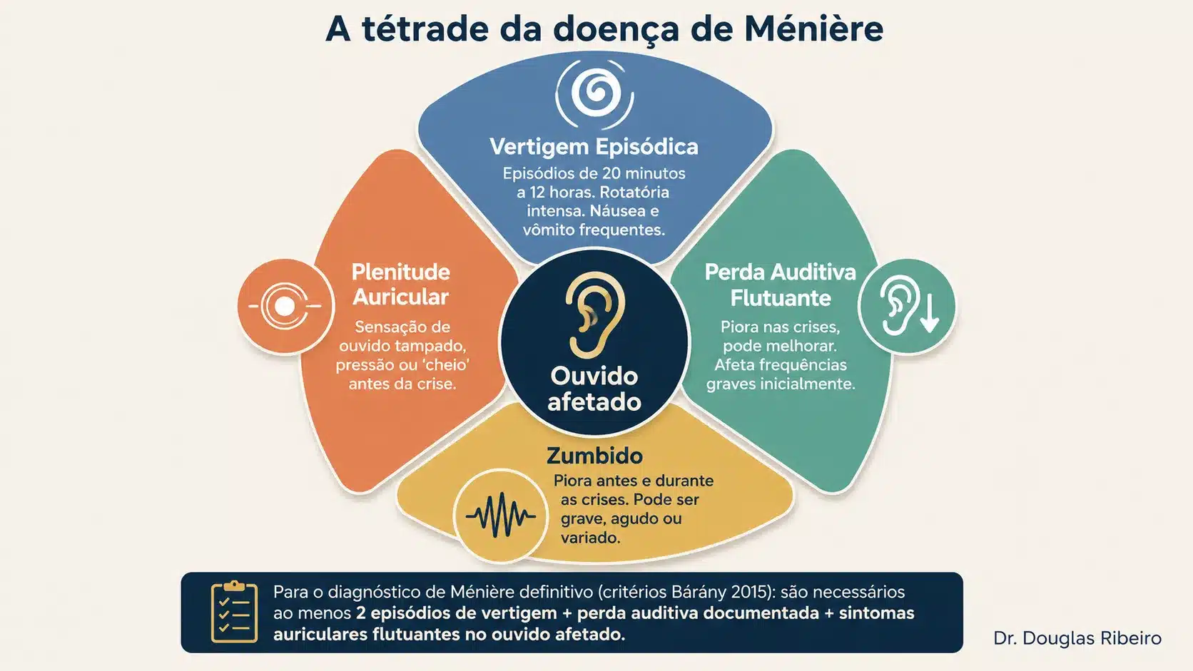 Diagrama circular mostrando a tétrade da doença de Ménière: vertigem episódica, perda auditiva flutuante, zumbido e plenitude auricular, todos centrados no ouvido afetado