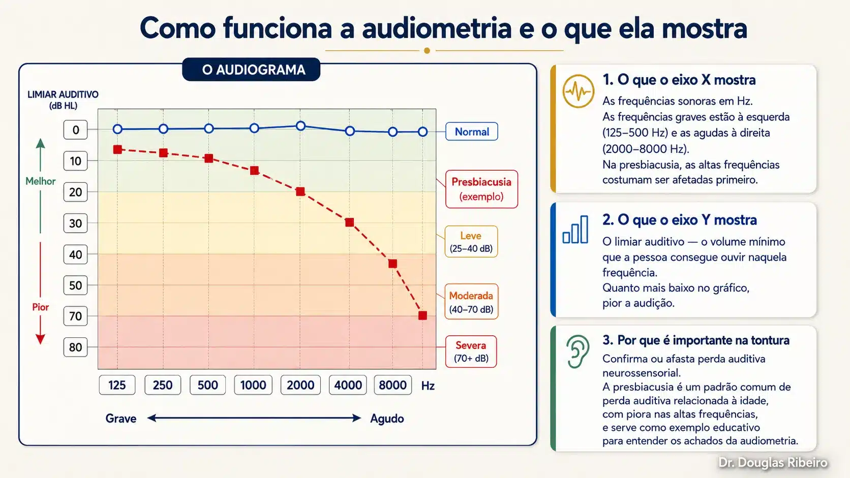 Audiograma educativo comparando audição normal com um exemplo de presbiacusia, mostrando perda auditiva progressiva nas frequências agudas e explicando os eixos de frequência e intensidade sonora.