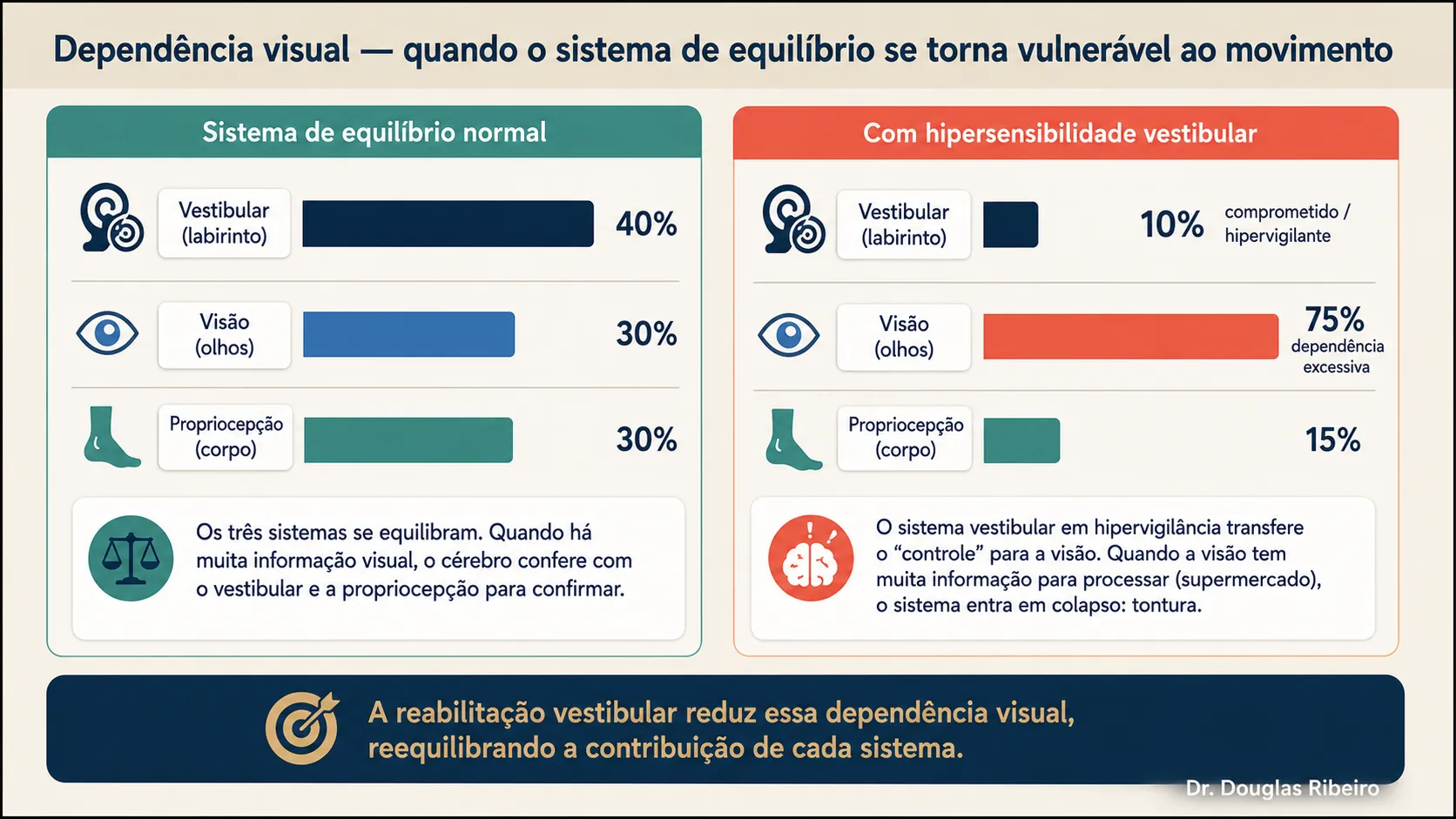 Diagrama comparando o sistema de equilíbrio normal, com contribuição equilibrada de vestibular, visão e propriocepção, com o sistema com dependência visual excessiva, onde o labirinto contribui menos e a visão sobrecarregada gera tontura em ambientes cheios