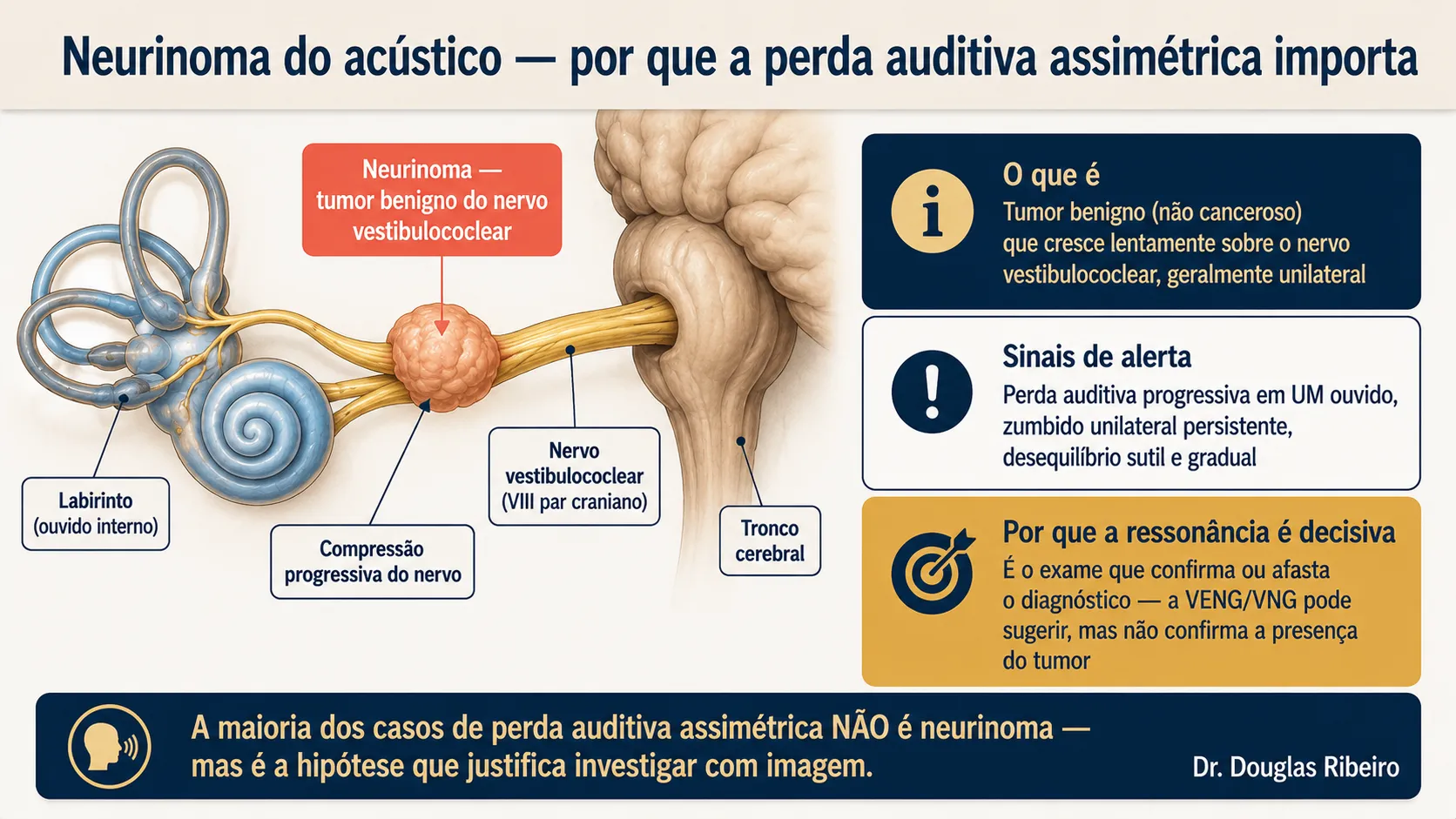 Diagrama anatômico mostrando o neurinoma do acústico — tumor benigno comprimindo o nervo vestibulococlear — e por que a perda auditiva assimétrica progressiva justifica investigação com ressonância magnética