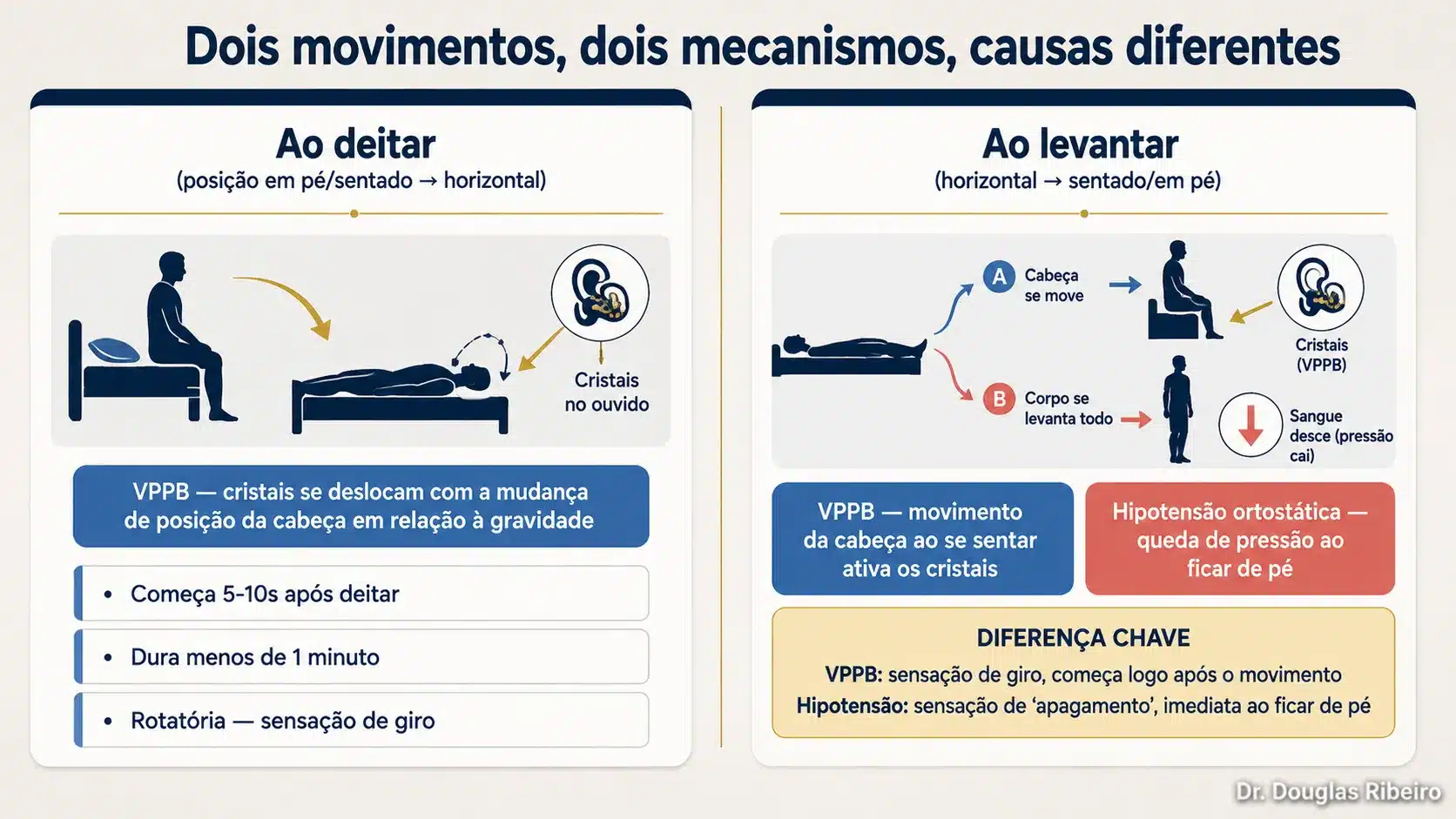 Diagrama comparando tontura ao deitar (principalmente VPPB) com tontura ao levantar (VPPB ou hipotensão ortostática), mostrando mecanismos diferentes